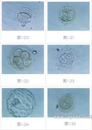 郑州代孕包男孩,试管婴儿胚胎移植具体过程及方式-上海供卵试管公司有哪些